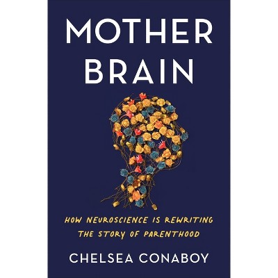 Mother Brain - by Chelsea Conaboy