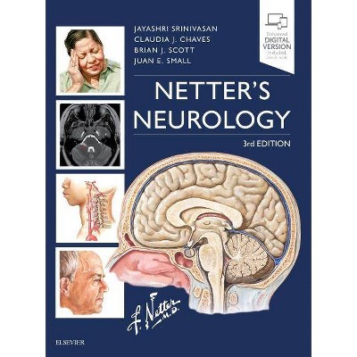 Netter's Neurology - (Netter Clinical Science) 3rd Edition by  Jayashri Srinivasan & Claudia Chaves & Brian Scott & Juan Small (Hardcover)