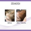 Zenagen Revolve Women Thickening Shampoo (6.75 oz) and Revolve Thickening Conditioner (6.75 oz) - DUO SET Kit - 3 of 3