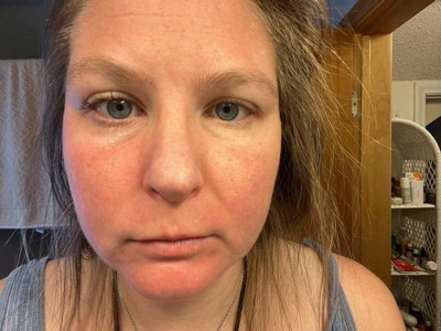 Guest review image 1 of 2, zoom in