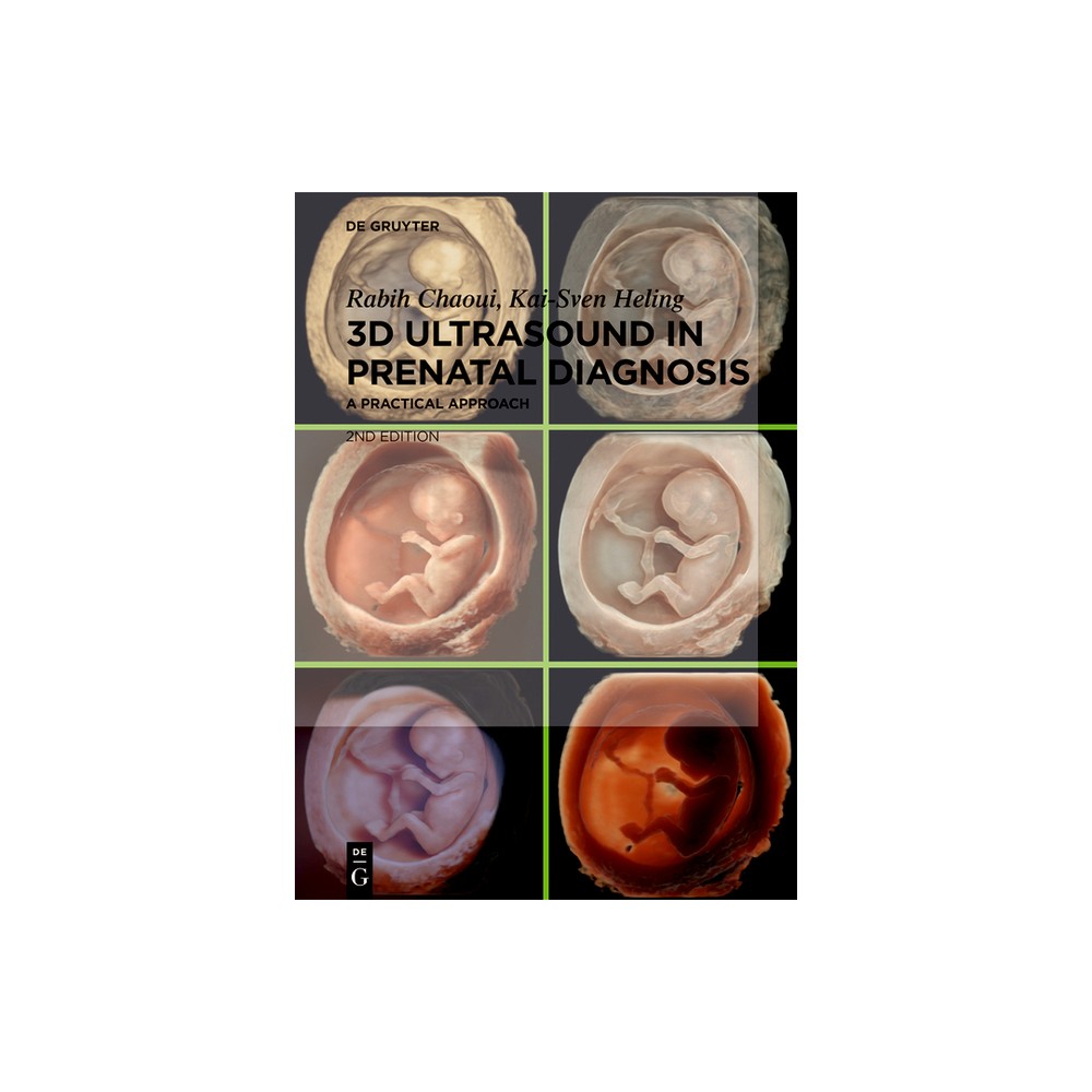 3D Ultrasound in Prenatal Diagnosis - 2nd Edition by Rabih Chaoui & Kai-Sven Heling (Hardcover)