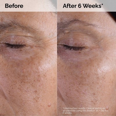 The Ordinary Glycolic Acid 7% Exfoliating and Brightening Daily Toner - 8 fl oz - Ulta Beauty