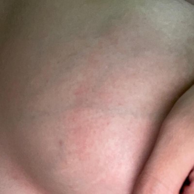 Frida Mom Breastfeeding Sore Nipple Set - 3.5oz/2pk : Target