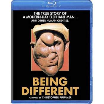 Being Different (Blu-ray)(2017)