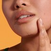 Hero Mighty Patch Chin - 10ct - 4 of 4