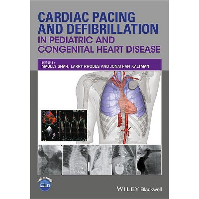 Cardiac Pacing and Defibrillation in Pediatric and Congenital Heart Disease - by  Maully Shah & Larry Rhodes & Jonathan Kaltman (Hardcover)
