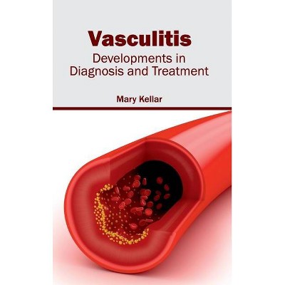 Vasculitis: Developments in Diagnosis and Treatment - by  Mary Kellar (Hardcover)