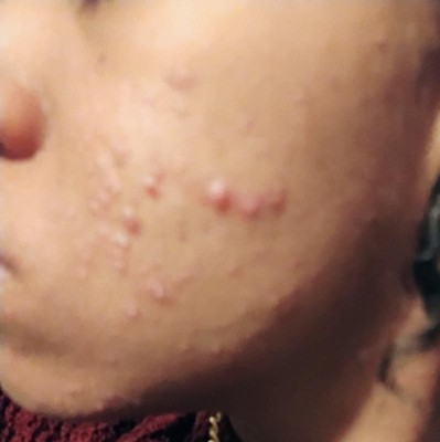 Guest review image 1 of 3, zoom in