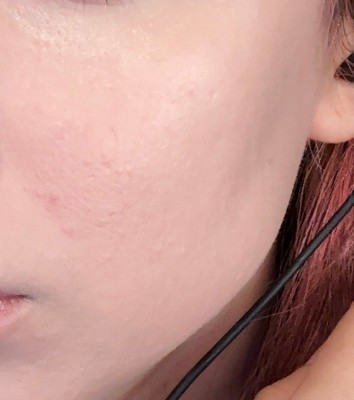 Guest review image 1 of 3, zoom in