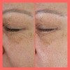 Peach & Lily Retinal For All Renewing Serum - 2.64 fl oz - Ulta Beauty - 3 of 4