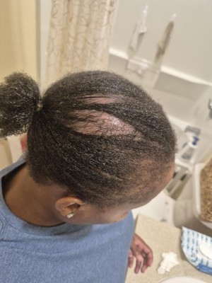 Guest review image 1 of 1, zoom in