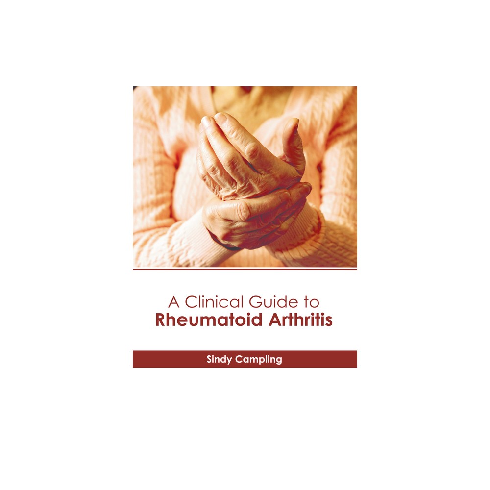 A Clinical Guide to Rheumatoid Arthritis - by Sindy Campling (Hardcover)
