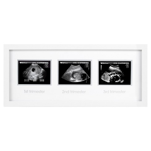 ultrasound picture frame hobby lobby