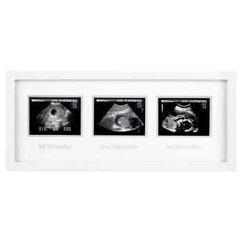 Pearhead Trimester Sonogram Frame - White