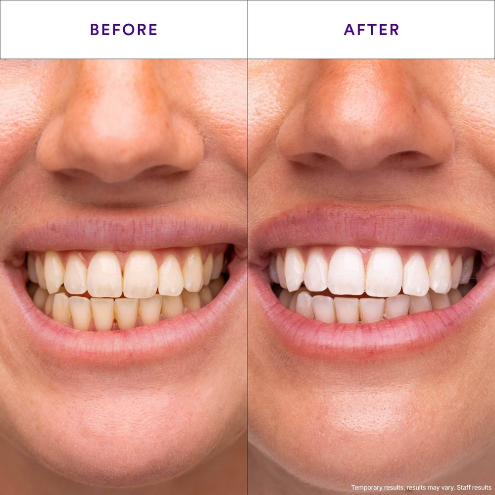 Hismile V34 Packaging