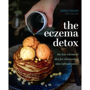 Eczema Detox - by  Karen Fischer (Hardcover) - 1 of 1