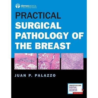 Practical Surgical Pathology of the Breast - by  Juan P Palazzo (Hardcover)