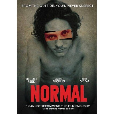 Normal (DVD)(2017)