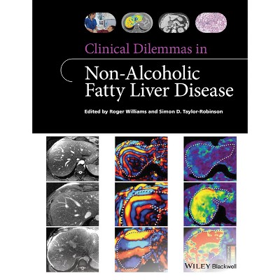 Clinical Dilemmas in Non-Alcoholic Fatty Liver Disease - (Clinical Dilemmas (UK)) by  Roger Williams & Simon D Taylor-Robinson (Paperback)