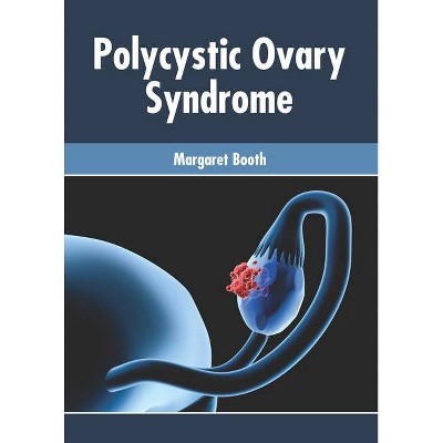 Polycystic Ovary Syndrome - by  Margaret Booth (Hardcover)