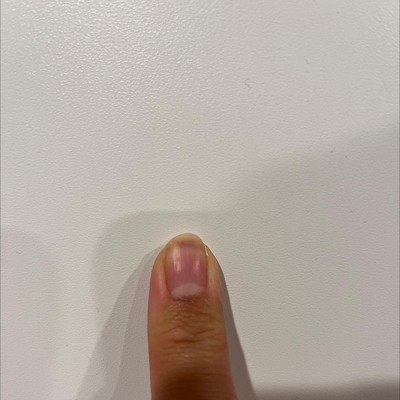 Guest review image 1 of 1, zoom in