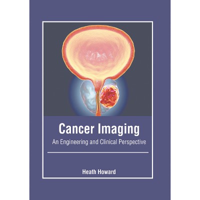 Cancer Imaging: An Engineering and Clinical Perspective - by  Heath Howard (Hardcover)