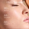 The Derma Roller by Project E Beauty | 540 Titanium Microneedle | 0.25mm Skincare Roller for Hair Growth, Face & Beard | Reduce Scarring & Wrinkles - 4 of 4
