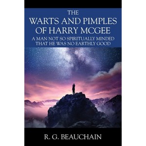 The Warts and Pimples of Harry McGee - by  R G Beauchain (Paperback) - 1 of 1