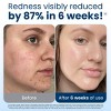 Clean Skin Club Disposable Face Towel for Improved Skin - XL - 10ct - 3 of 4