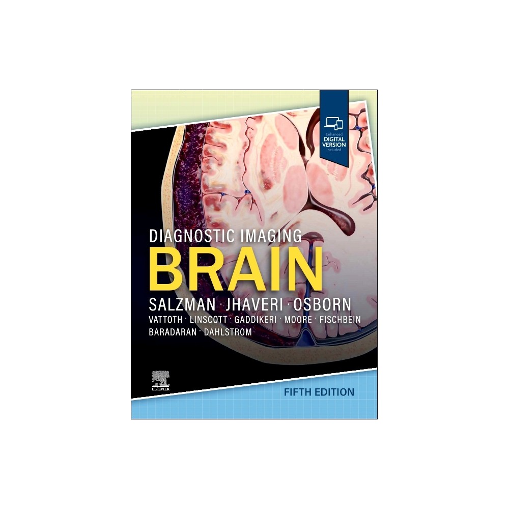 Diagnostic Imaging: Brain - 5th Edition by Karen L Salzman & Miral D Jhaveri (Hardcover)