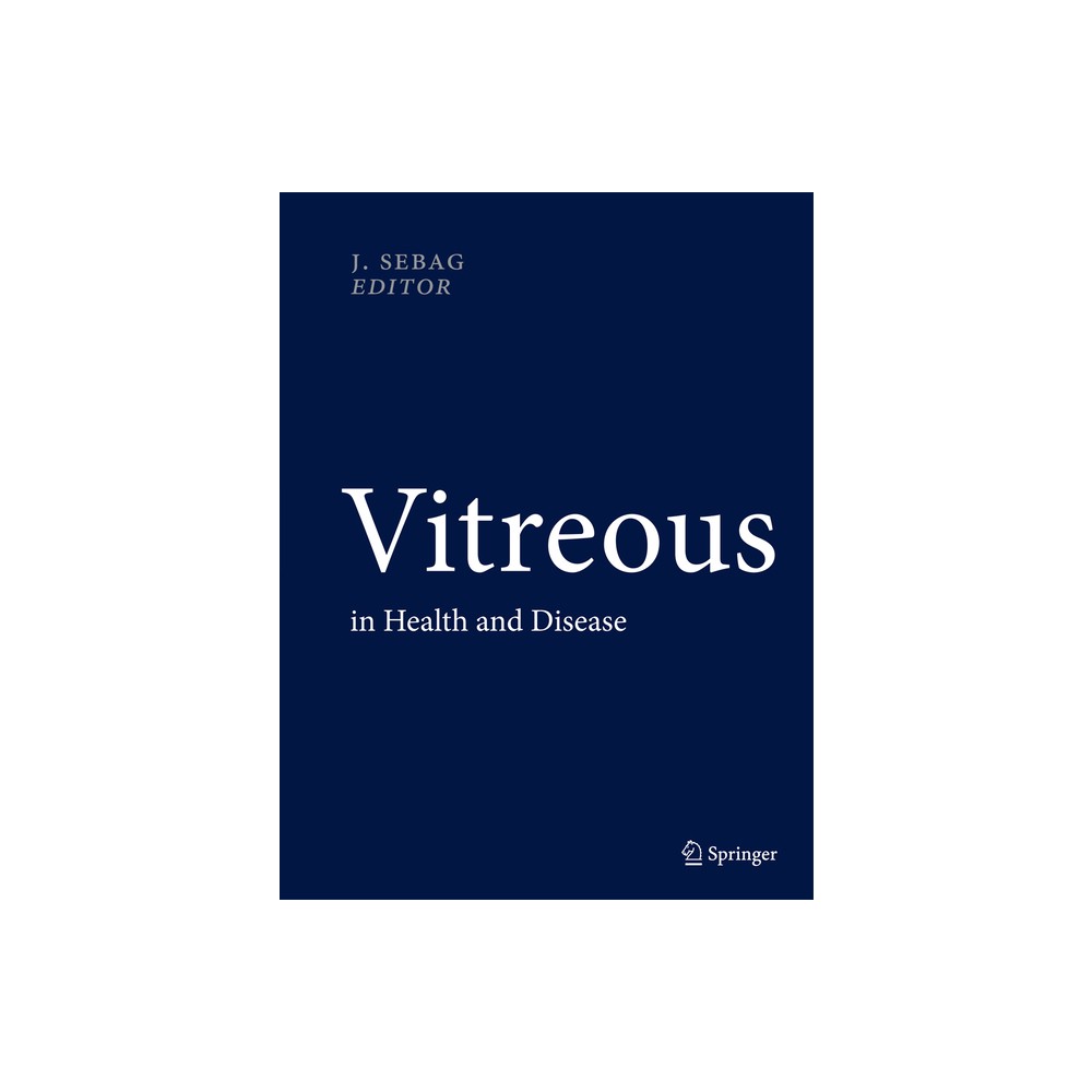 Vitreous - by J Sebag (Hardcover)