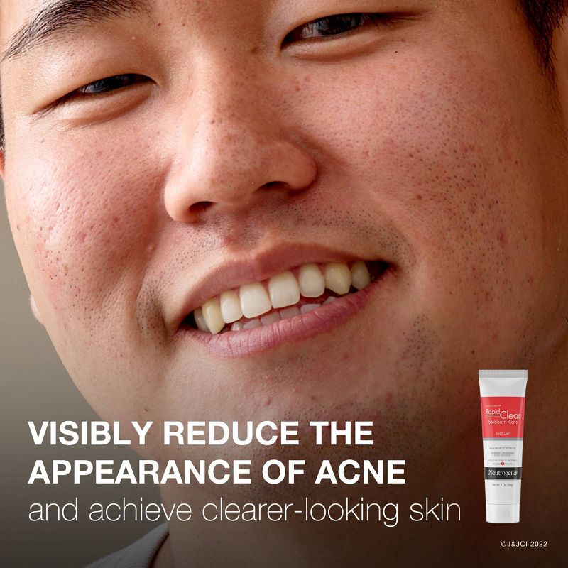 Neutrogena Rapid Clear Stubborn Acne Spot Treatment Gel with Maximum Strength for Acne Prone Skin - 1 oz, 4 of 13