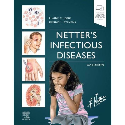 Netter's Infectious Diseases - 2nd Edition by  Elaine C Jong & Dennis L Stevens (Hardcover)