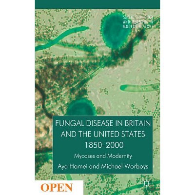 Fungal Disease in Britain and the United States 1850-2000 - (Science, Technology and Medicine in Modern History) by  A Homei & M Worboys (Hardcover)