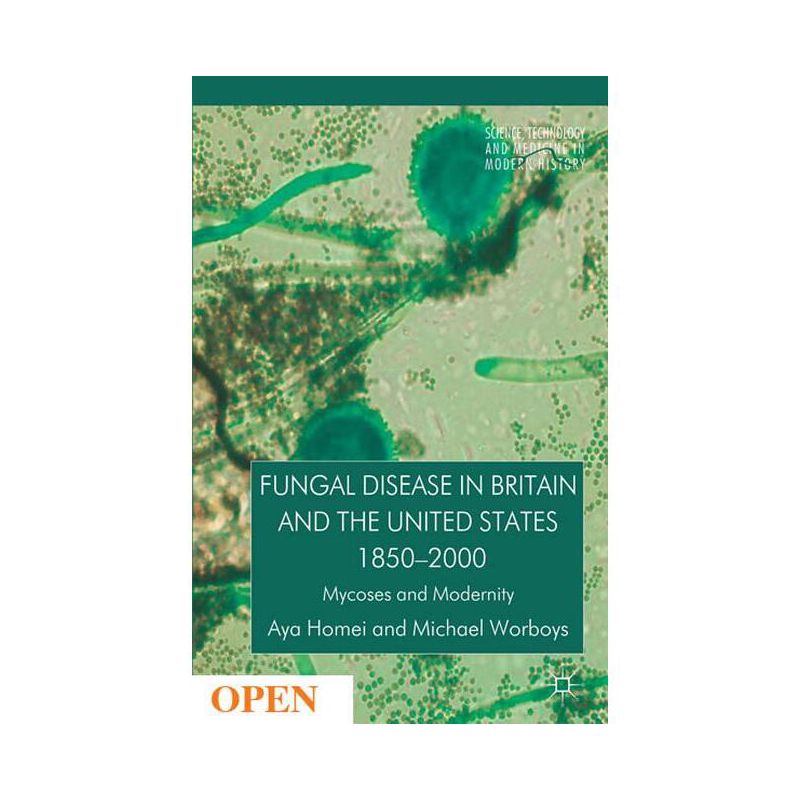 Fungal Disease in Britain and the United States 1850-2000 - (Science, Technology and Medicine in Modern History) by  A Homei & M Worboys (Hardcover), 1 of 2