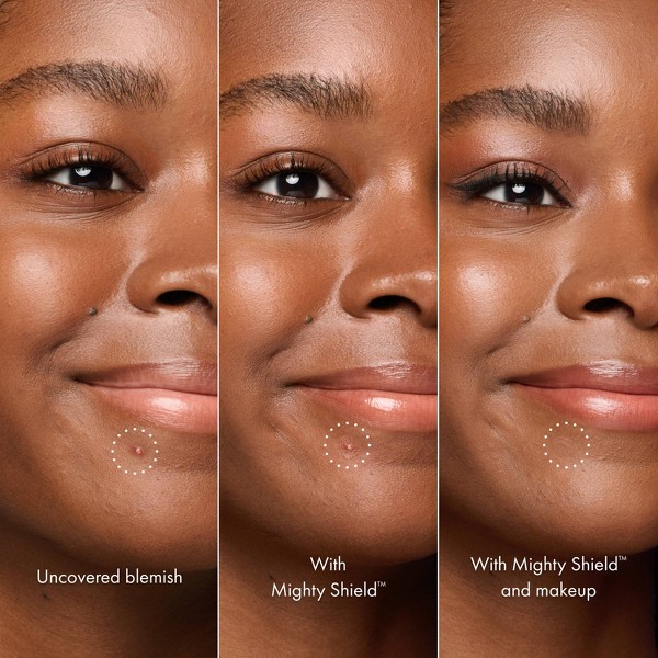 Hero Cosmetics Mighty Shield Parche líquido invisible protector de imperfecciones - 10ml: Sin fragancia, Sin colorantes artificiales, Piel propensa al acné 4