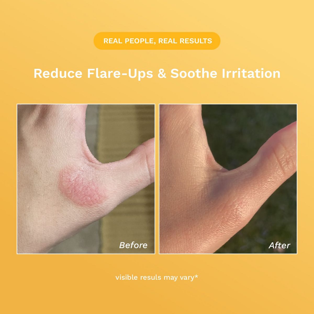 Rejuvaskin Skin Recovery Cream - thumbnail 6