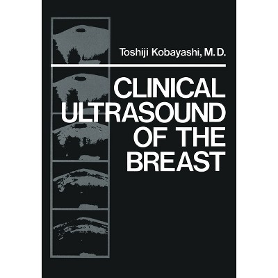 Clinical Ultrasound of the Breast - by  Toshiji Kobayashi (Paperback)