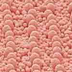 coral