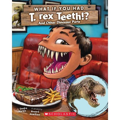 What If You Had T. Rex Teeth?: And Other Dinosaur Parts - (What If You Had... ?) by  Sandra Markle (Paperback)