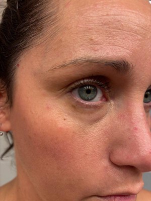 Guest review image 1 of 2, zoom in