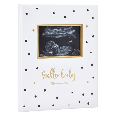 Pearhead Baby Memory Book And Baby Belly Sticker Set Floral Photo And Scrapbook  Albums : Target