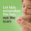 Mederma Scar Treatment for Kids - 0.7oz - image 3 of 4