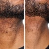 Urban Skin Rx Men's Daily Exfoliating Face Wash + Scrub - 5.1 fl oz - image 3 of 4