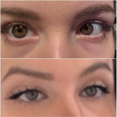 Guest review image 1 of 1, zoom in