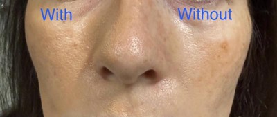 Guest review image 2 of 2, zoom in