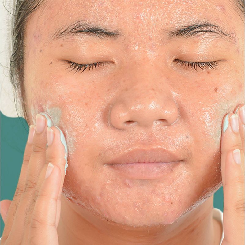 Neutrogena Oil-Free Acne Stress Control Power-Clear Facial Scrub for Acne-Prone Skin Care - 4.2 fl oz, 3 of 8