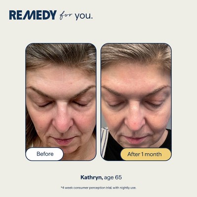 Remedy Skin Healthy Aging Serum with Retinol, Glycolic Acid, Niacinamide, Argireline for Fine lines, Wrinkles, Firmness and Elasticity - 1 fl oz