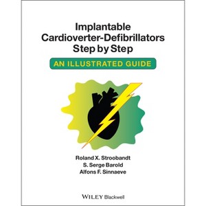 Implantable Cardioverter - Defibrillators Step by Step - by  Roland X Stroobandt & S Serge Barold & Alfons F Sinnaeve (Paperback) - 1 of 1