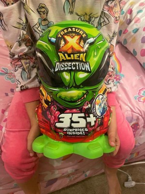 Treasure X Mega Alien Dissection Action Figure Set : Target